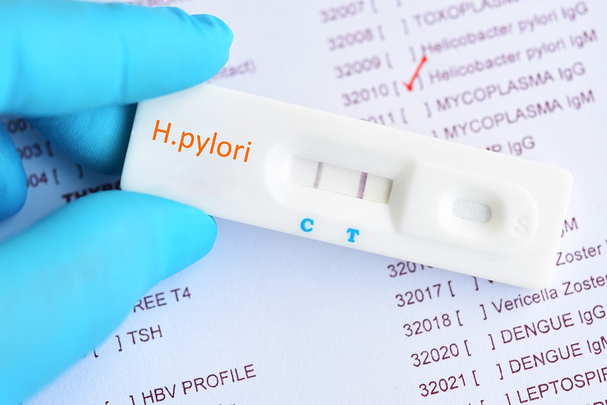 Understanding Helicobacter pylori and Testing