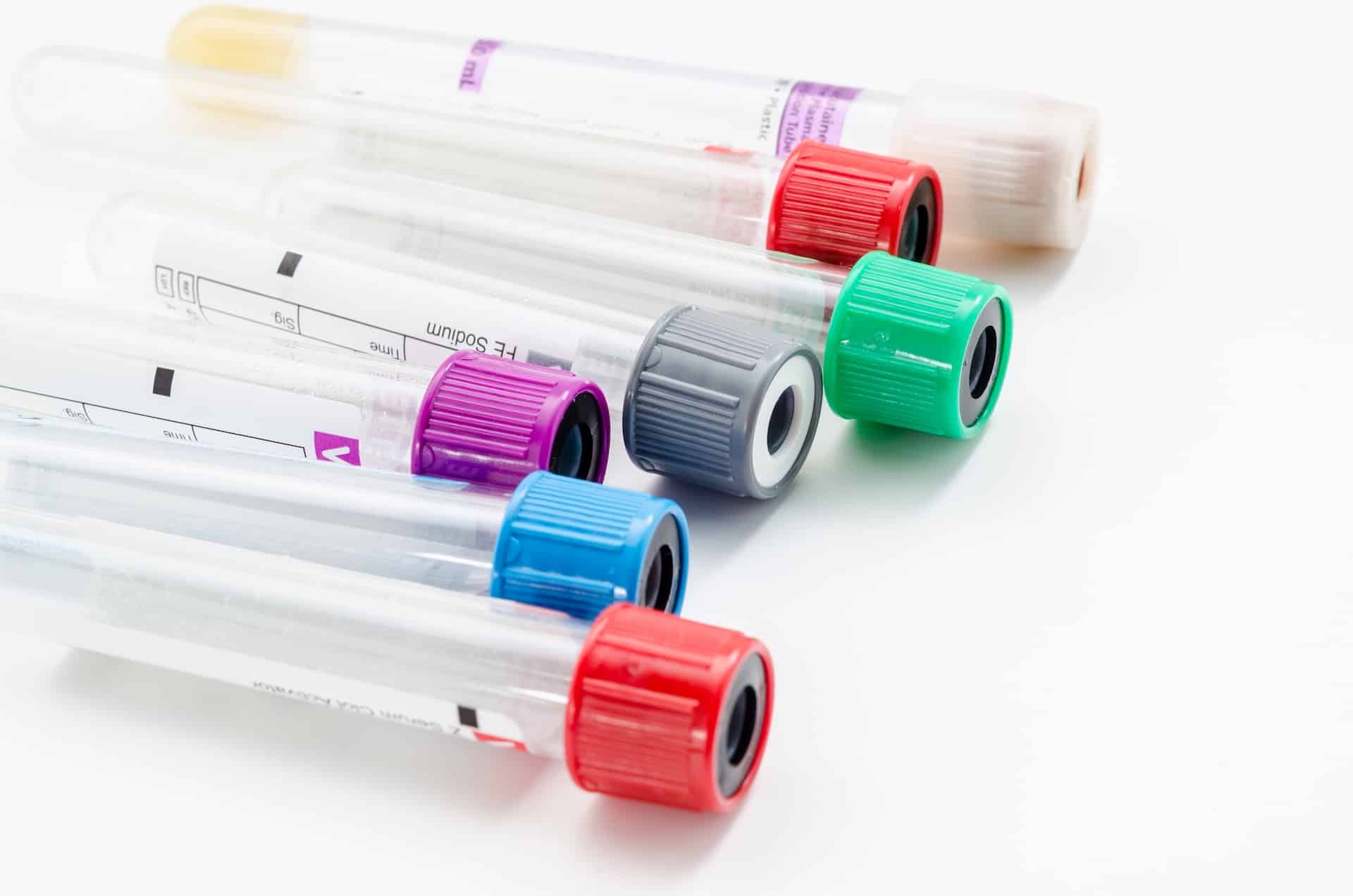 Stay Healthy with Annual Bloodwork!