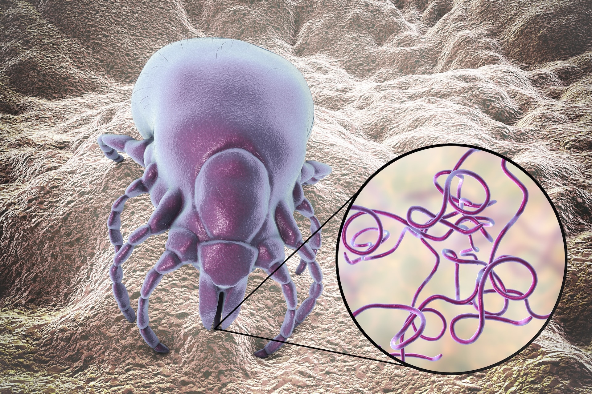 Understanding Lyme Borreliosis and Coinfections